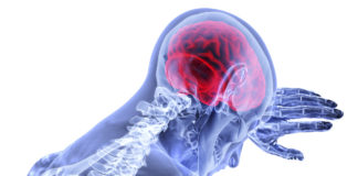 Vitamin D no defense against dementia