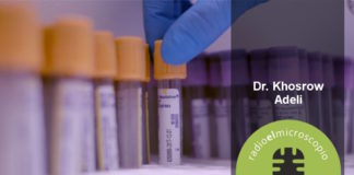 La medición de lípidos en estado postprandial representa mejor nuestros hábitos