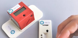 Crean un dispositivo que detecta lesiones cerebrales leves con una gota de sangre