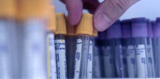 Enfermedades digestivas eosinofílicas