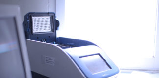 Expertos en Salud Pública descubrieron un brote oculto de fiebre Zika en 2017