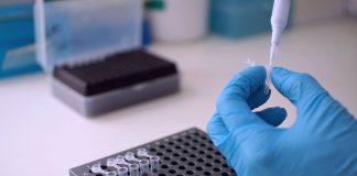 Las infecciones oportunistas continúan siendo frecuentes en personas con el VIH