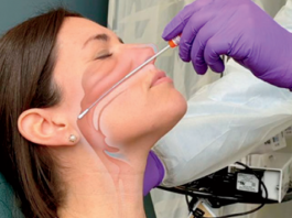 How to Obtain a Nasopharyngeal Swab Specimen