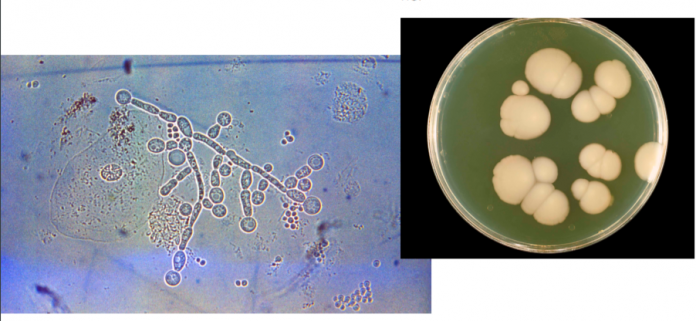 candida