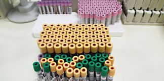 Optimización de un método de Cromatografía líquida acoplada a espectrometría de masa para la determinación de ácidos grasos poliinsaturados en plasma