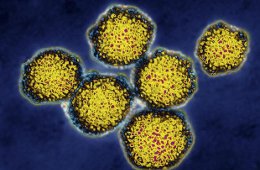 Entrevista Múltiple